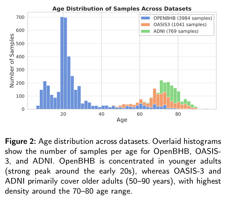 Age distribution across datasets.