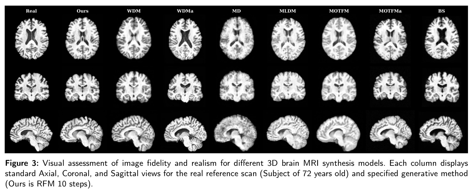 Visual assessment of image fidelity and realism for different 3D brain MRI synthesis models.