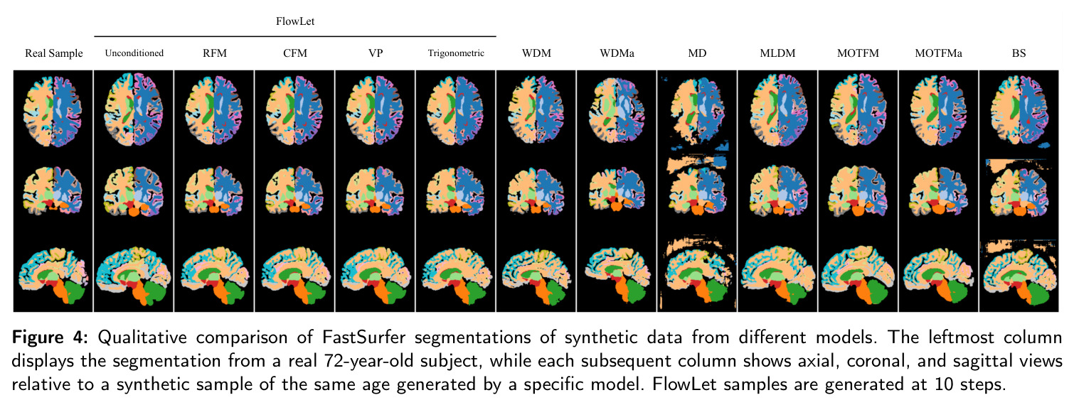 Qualitative comparison of FastSurfer segmentations of synthetic data from different models.