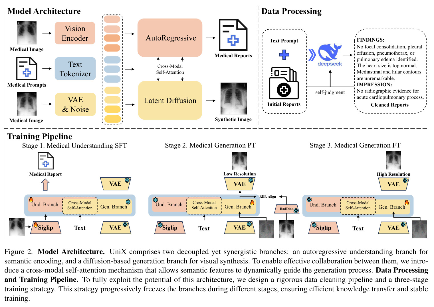 Model Architecture, Data Processing and Training Pipeline