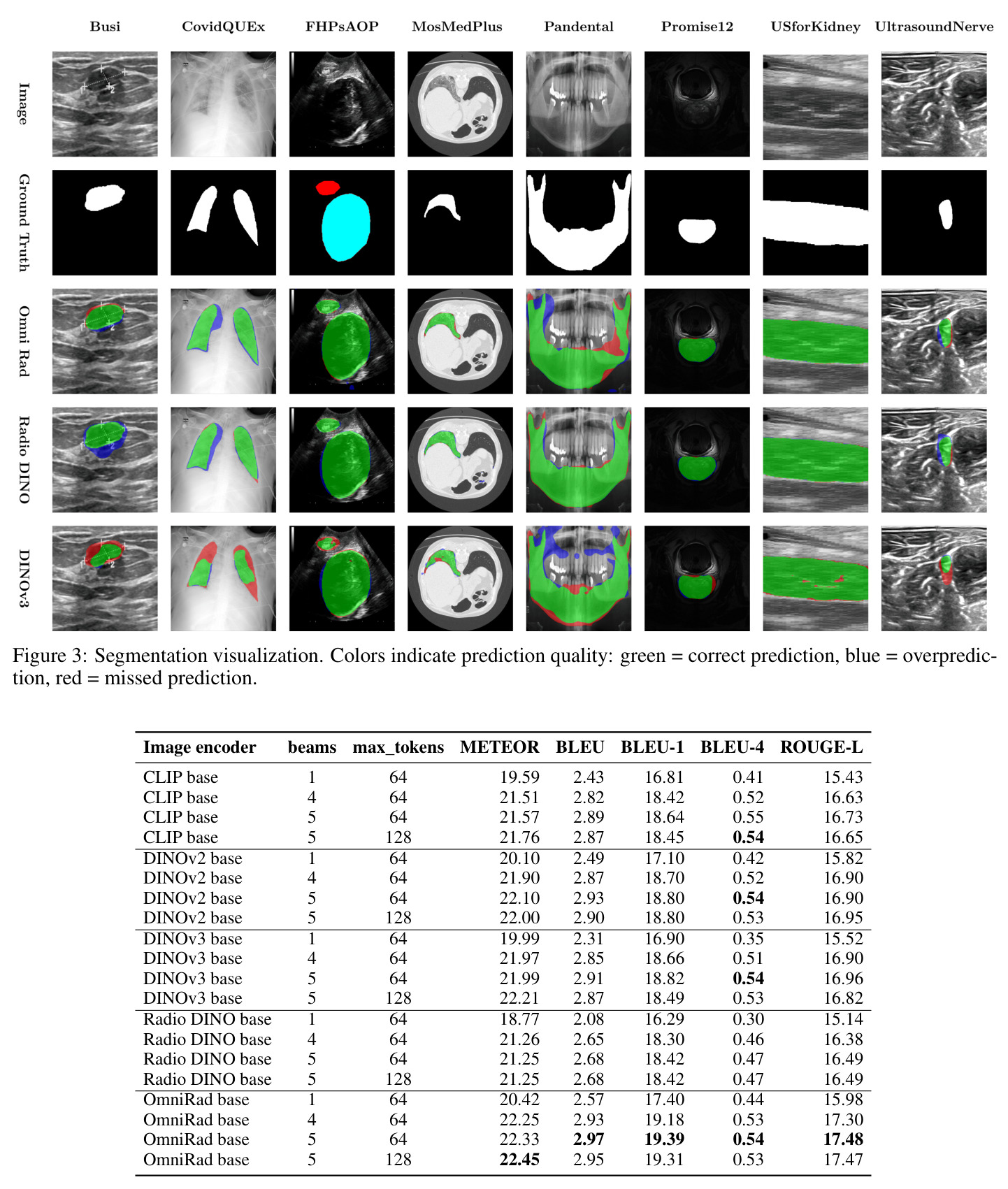 Segmentation visualization