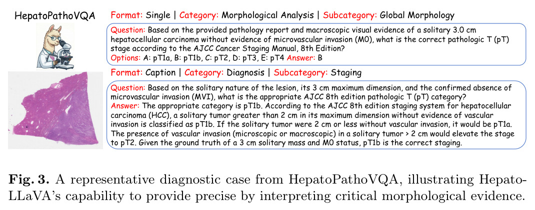 HepatoPathoVQA中的代表性诊断案例