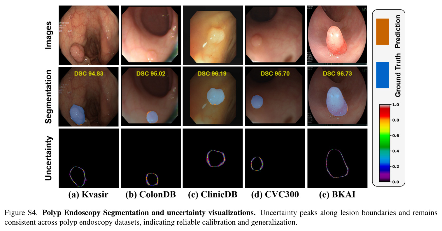 Segmentation and uncertainty visualizations. Uncertainty peaks along lesion boundaries and remains consistent across diverse datasets, indicating reliable calibration and generalization. ID data are in blue while OOD data are in red.