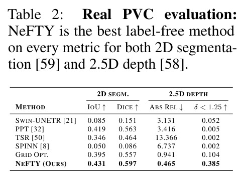 Real PVC evaluation: NeFTY is the best label-free method on every metric for both 2D segmentation and 2.5D depth.