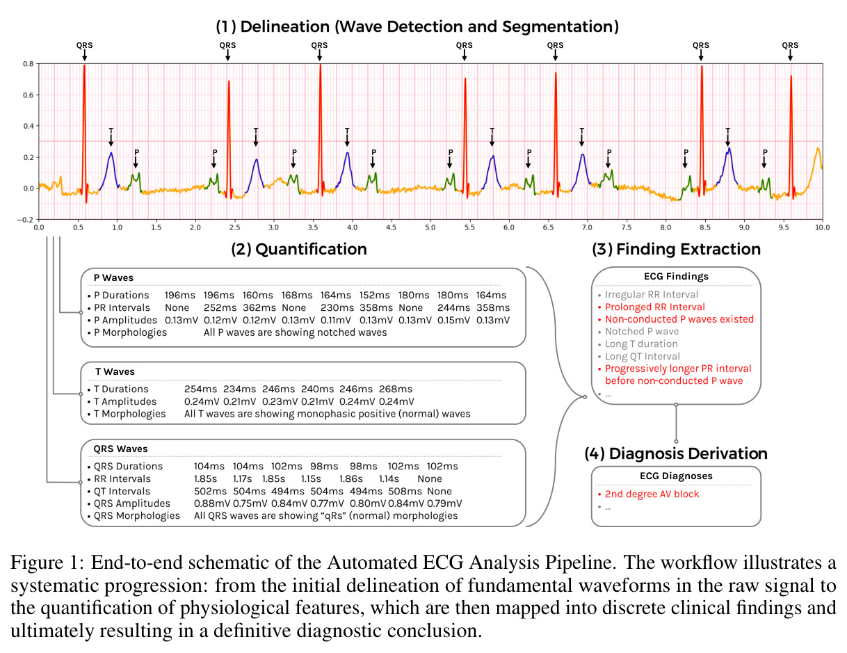 End-to-end schematic of the Automated ECG Analysis Pipeline.