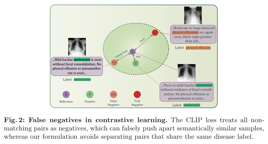False negatives in contrastive learning