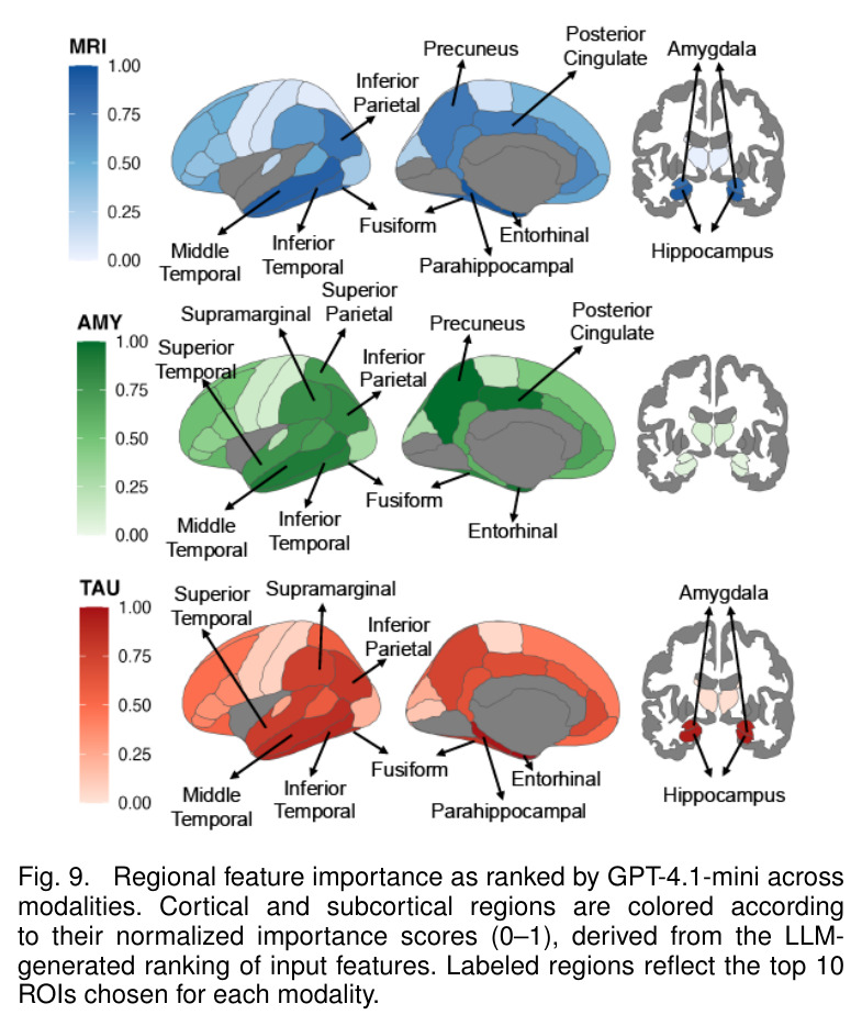 Regional feature importance as ranked by GPT-4.1-mini across modalities
