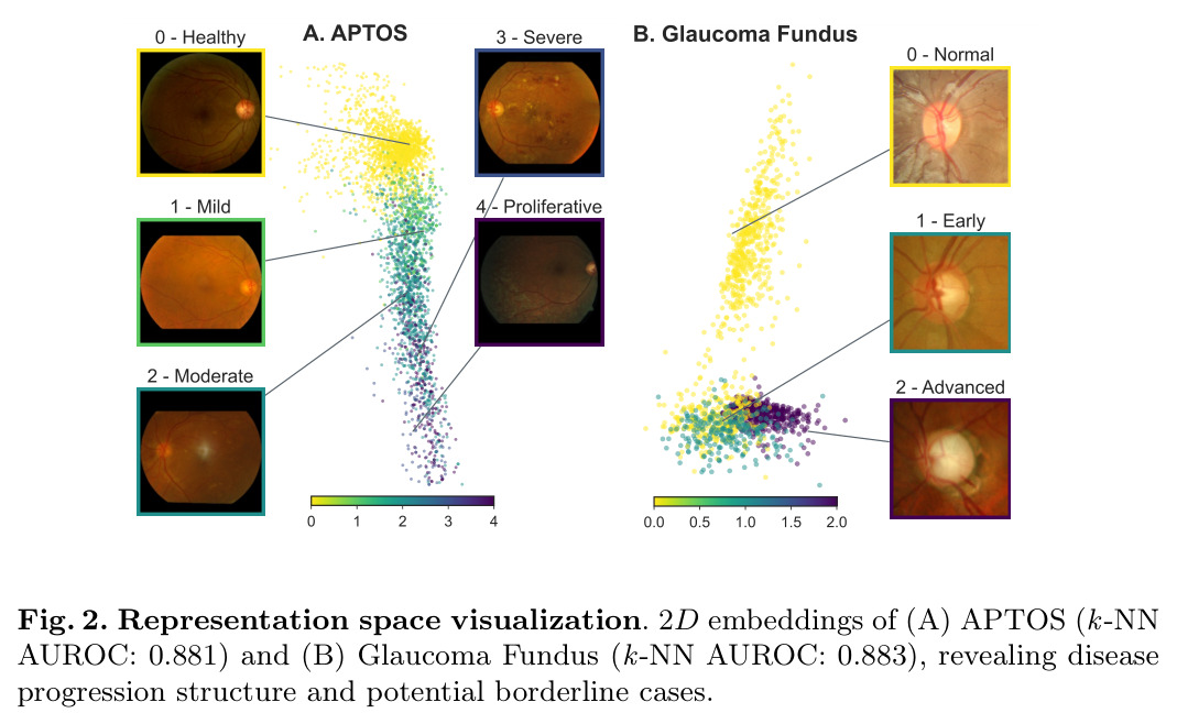 Representation space visualization.