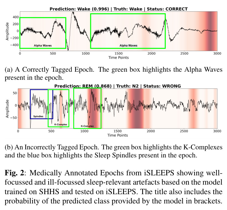 Medically Annotated Epochs from iSLEEPS showing well-focussed and ill-focussed sleep-relevant artefacts based on the model trained on SHHS and tested on iSLEEPS.