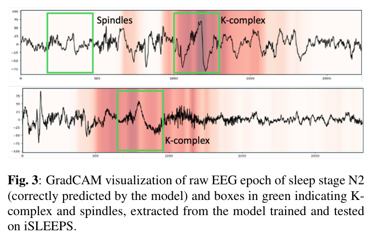 GradCAM visualization of raw EEG epoch of sleep stage N2 (correctly predicted by the model) and boxes in green indicating K-complex and spindles, extracted from the model trained and tested on iSLEEPS.