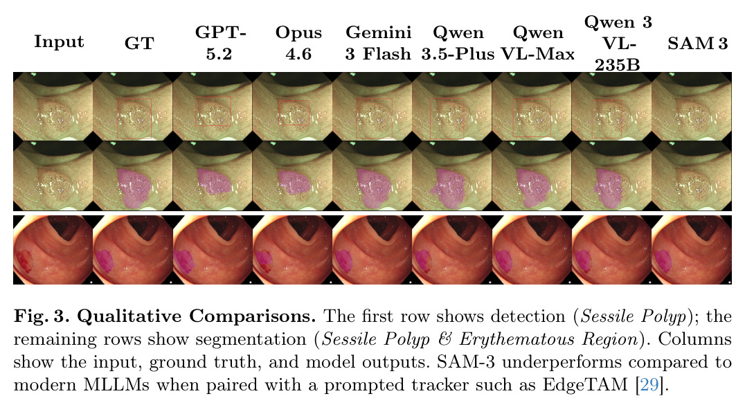 Qualitative Comparisons