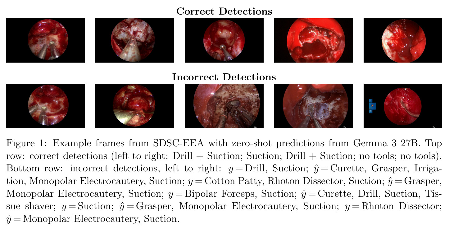 Example frames from SDSC-EEA with zero-shot predictions from Gemma 3 27B.