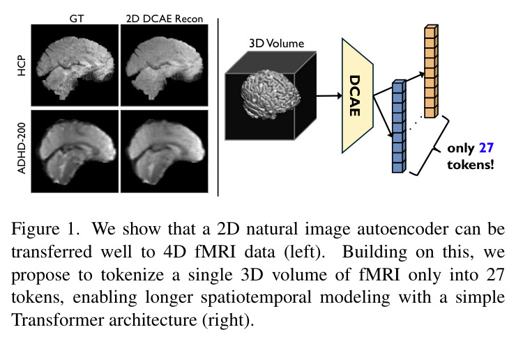 2D 自然图像自编码器迁移到 4D fMRI 数据的整体示意