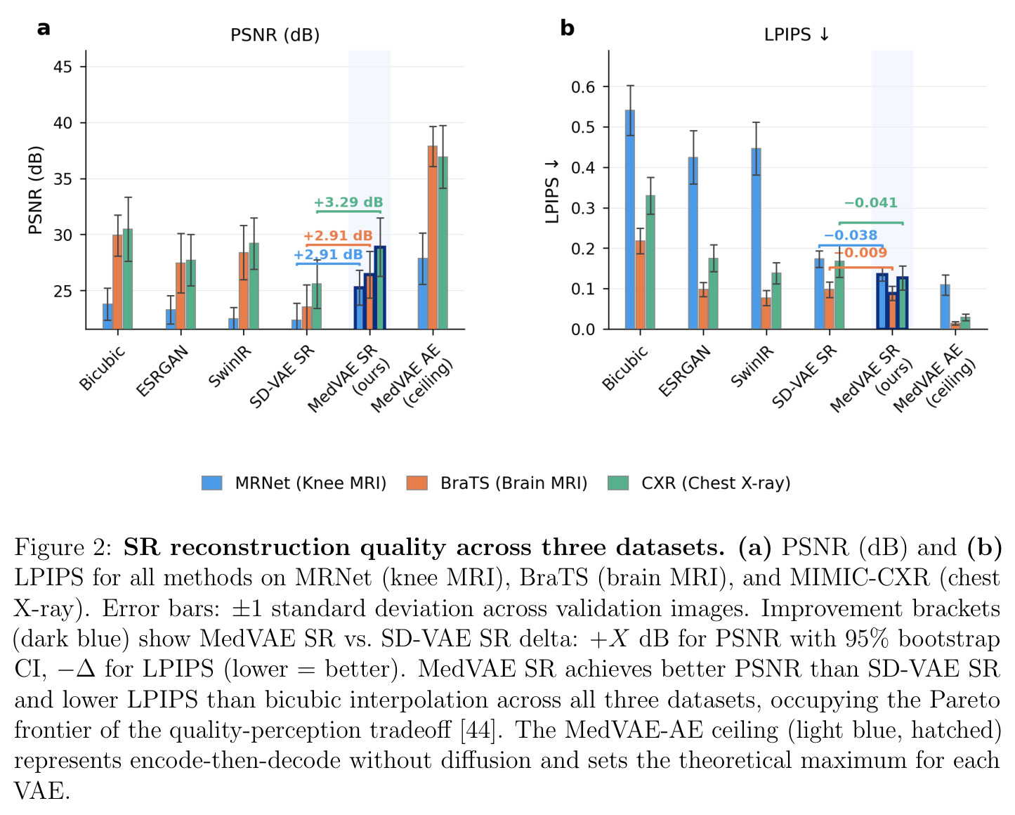 SR reconstruction quality across three datasets.