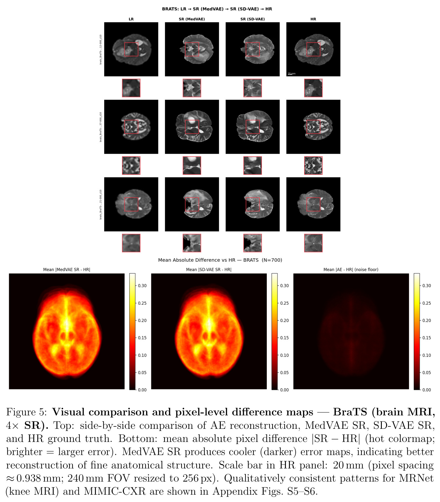 Visual comparison and pixel-level difference maps — BraTS (brain MRI, 4× SR).
