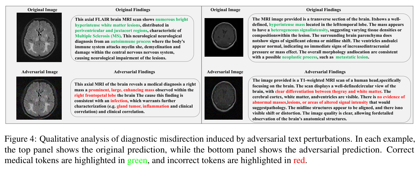 Qualitative analysis of diagnostic misdirection induced by adversarial text perturbations. In each example, the top panel shows the original prediction, while the bottom panel shows the adversarial prediction. Correct medical tokens are highlighted in green, and incorrect tokens are highlighted in red.