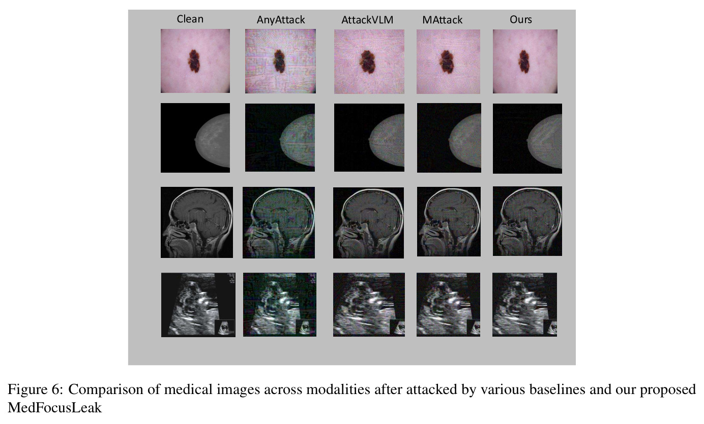 Comparison of medical images across modalities after attacked by various baselines and our proposed MedFocusLeak
