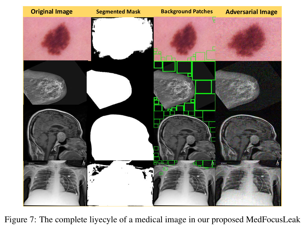 The complete lifecycle of a medical image in our proposed MedFocusLeak