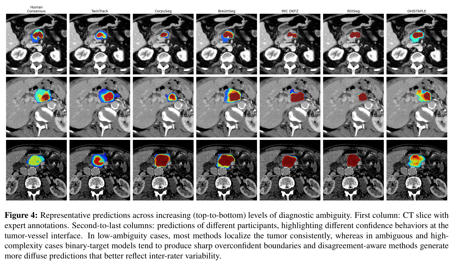Representative predictions across increasing levels of diagnostic ambiguity