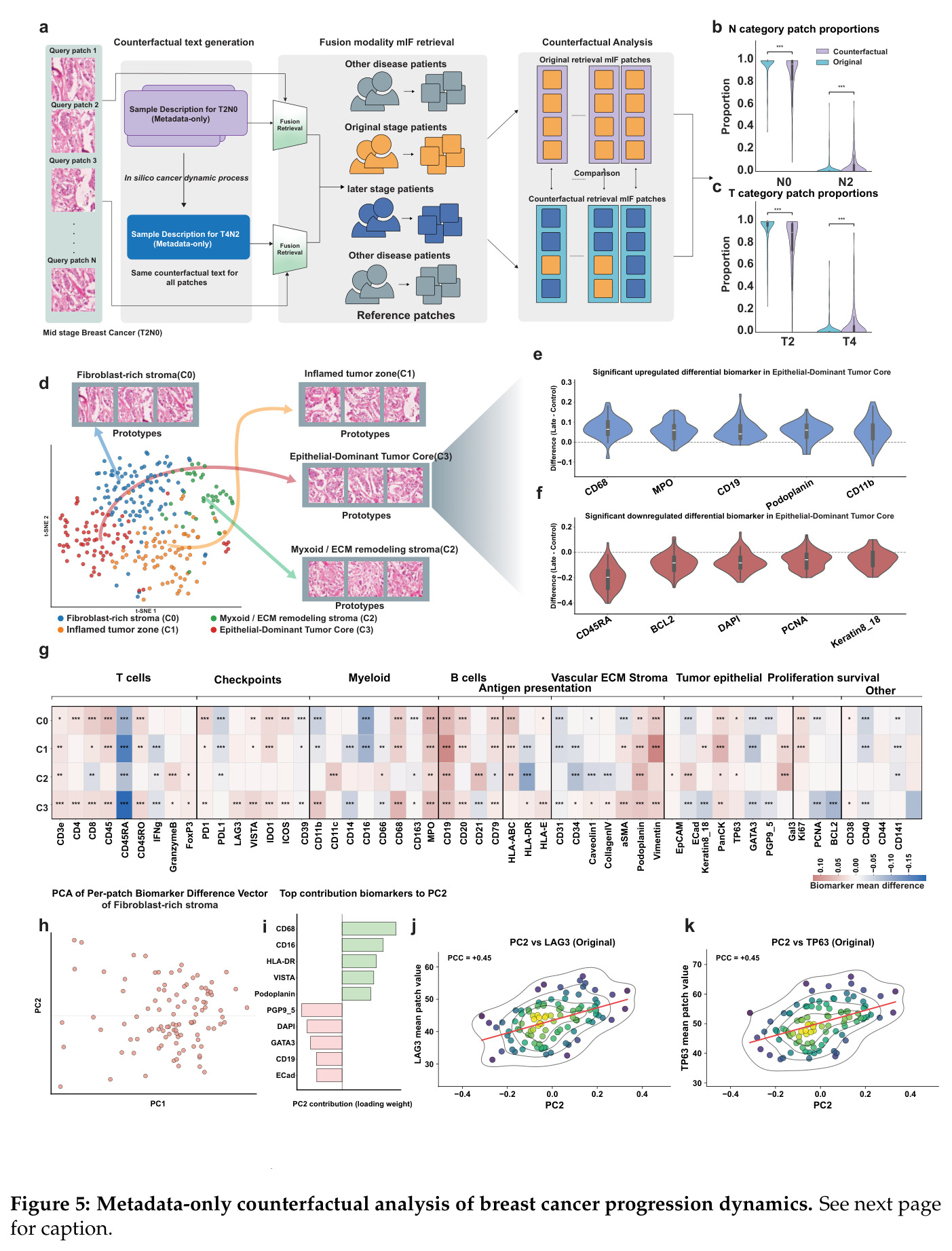 Metadata-only counterfactual analysis of breast cancer progression dynamics