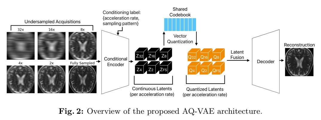 Overview of the proposed AQ-VAE architecture