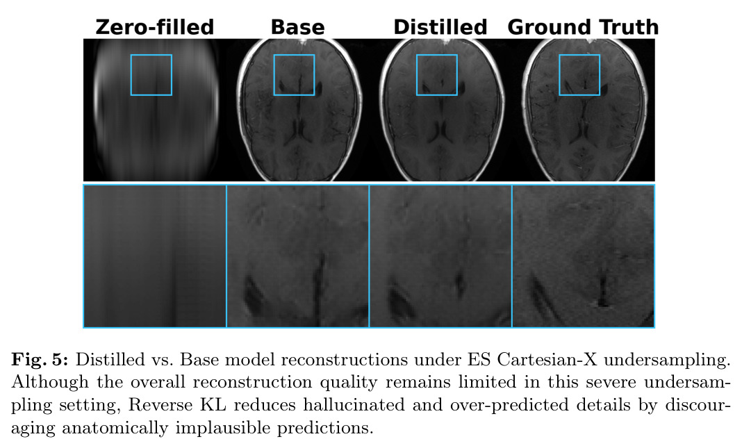 Distilled vs. Base model reconstructions under ES Cartesian-X undersampling