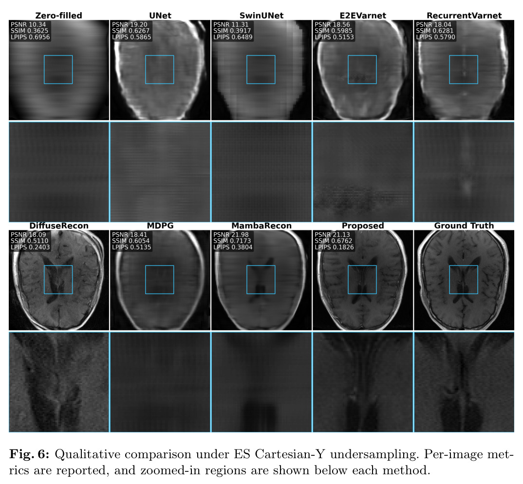 Qualitative comparison under ES Cartesian-Y undersampling