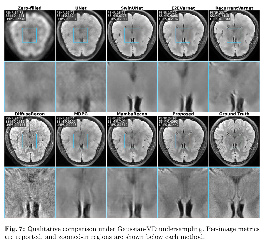 Qualitative comparison under Gaussian-VD undersampling