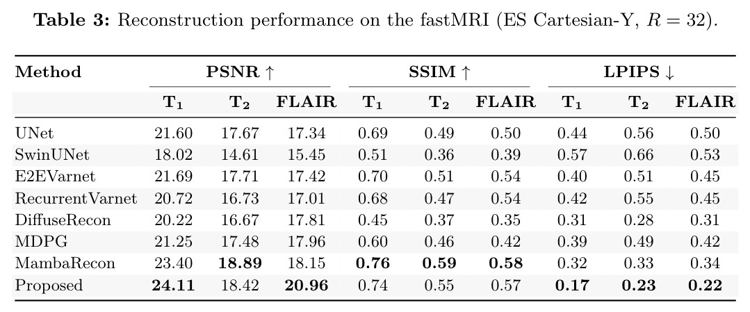 Reconstruction performance on the fastMRI (ES Cartesian-Y, R = 32)