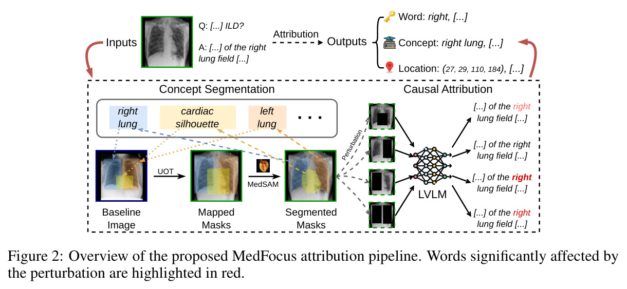 Overview of the proposed MedFocus attribution pipeline.