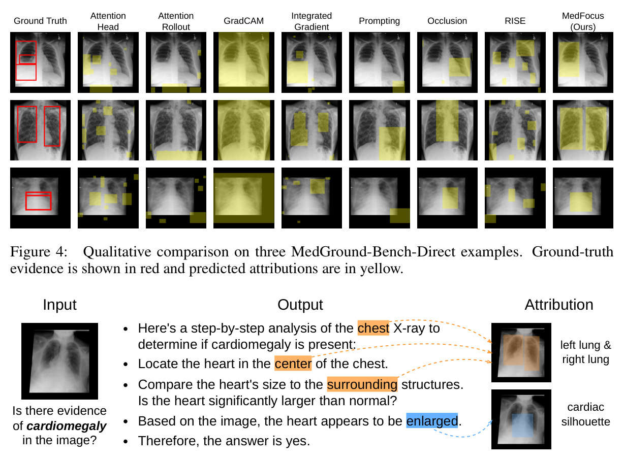 Qualitative comparison on three MedGround-Bench-Direct examples.