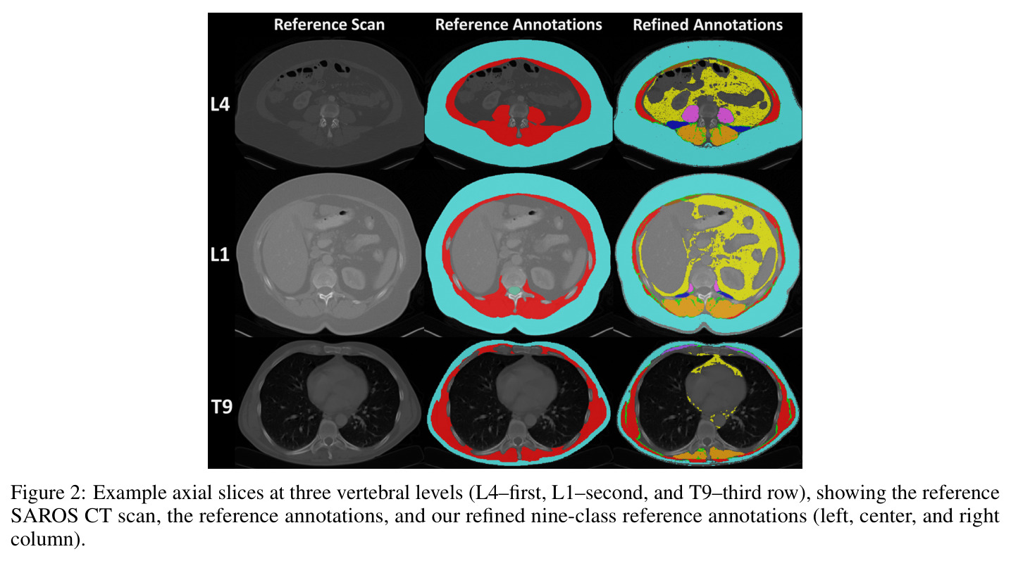 Example axial slices at three vertebral levels