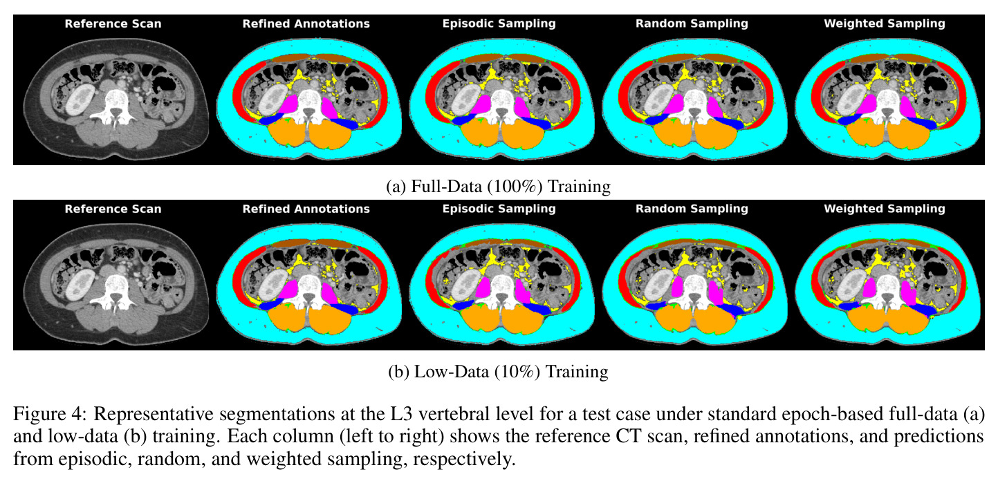 Representative segmentations at the L3 vertebral level
