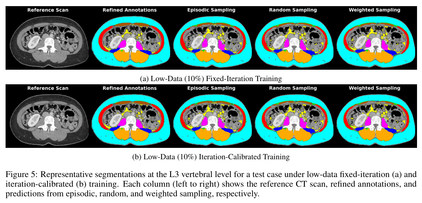 Representative segmentations under low-data fixed-iteration and iteration-calibrated training