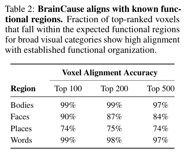 BrainCause aligns with known functional regions.