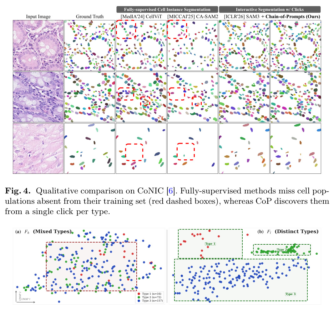 Qualitative comparison on CoNIC [6].