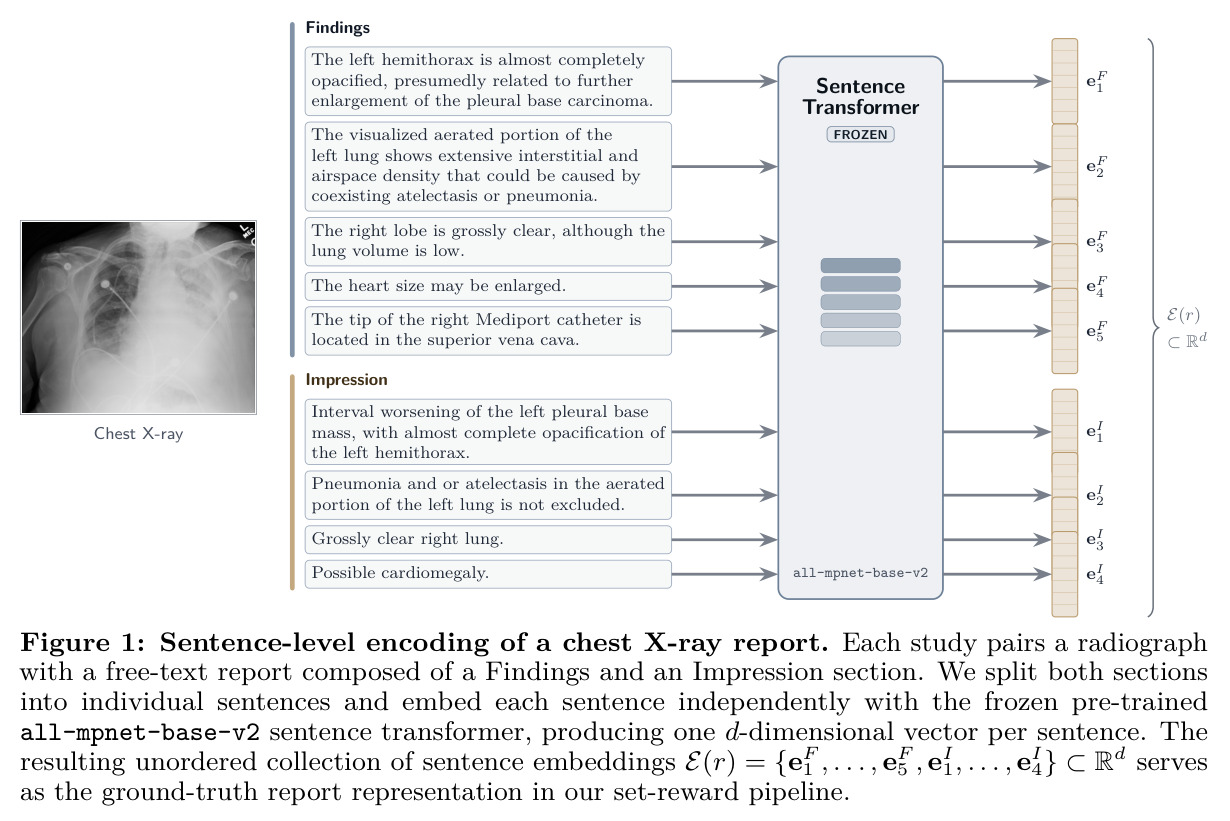 Sentence-level encoding of a chest X-ray report