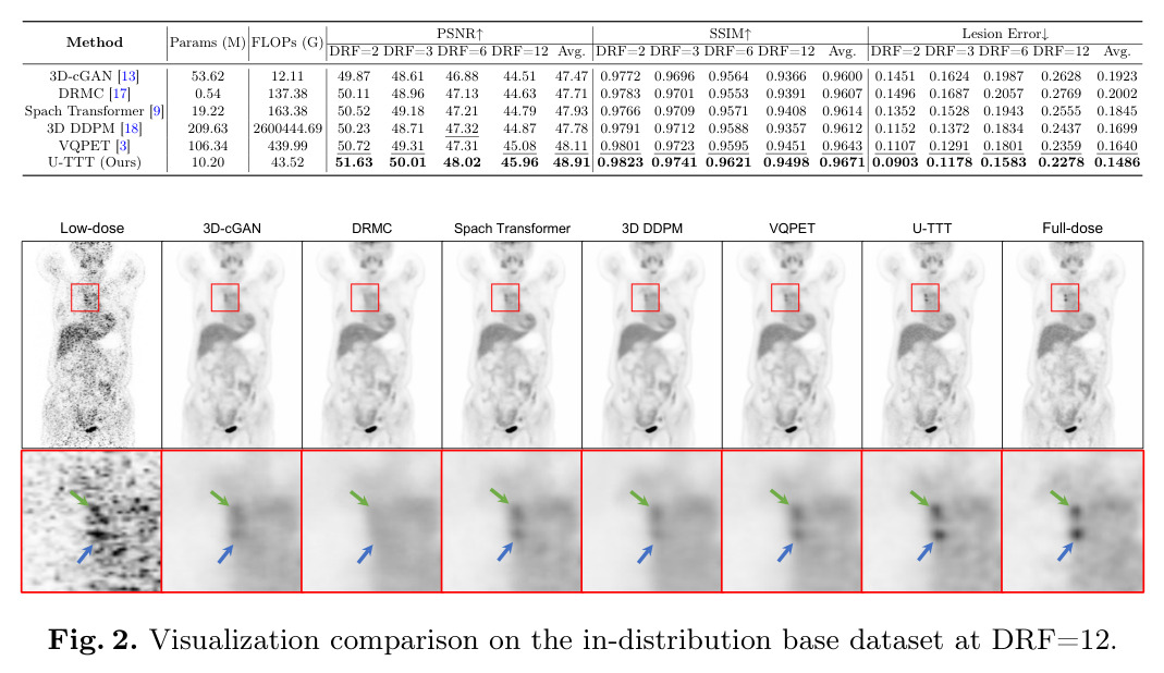 Visualization comparison on the in-distribution base dataset at DRF=12.