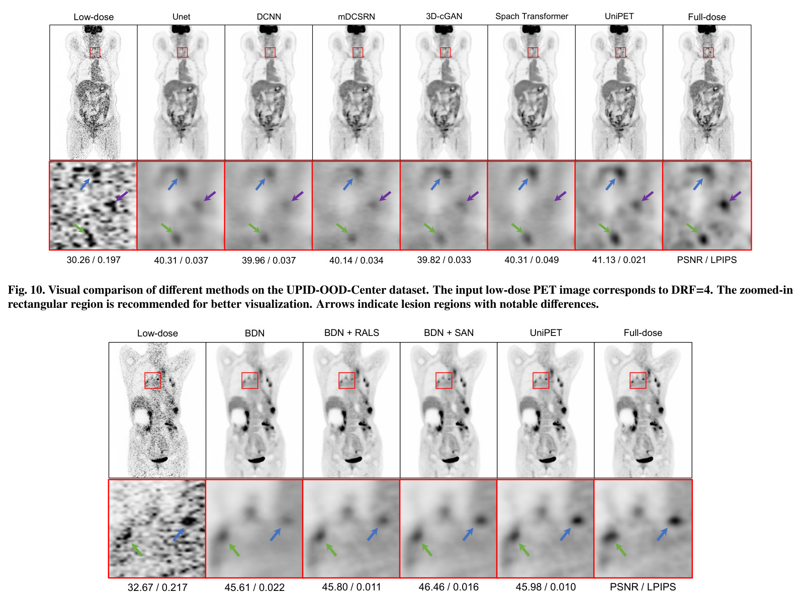 Visual comparison of different methods on the UPID-Base dataset.