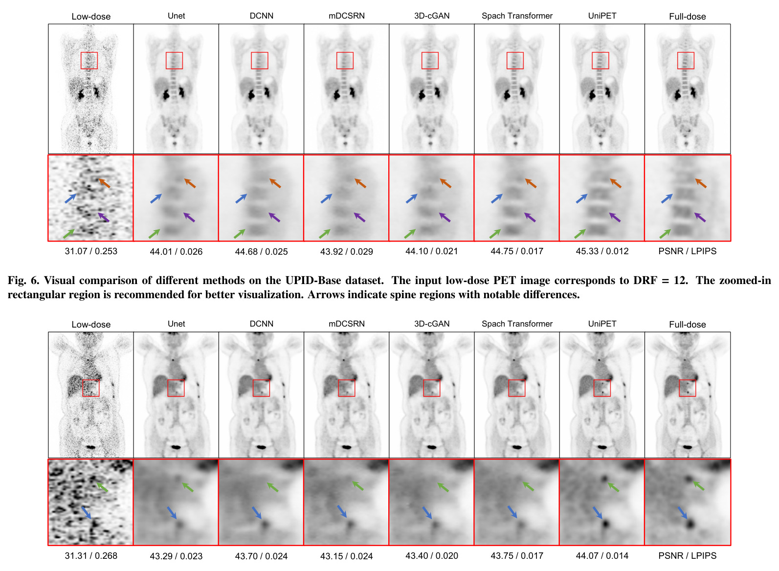 ROC curves of different methods on the UPID-Base dataset at different DRFs.