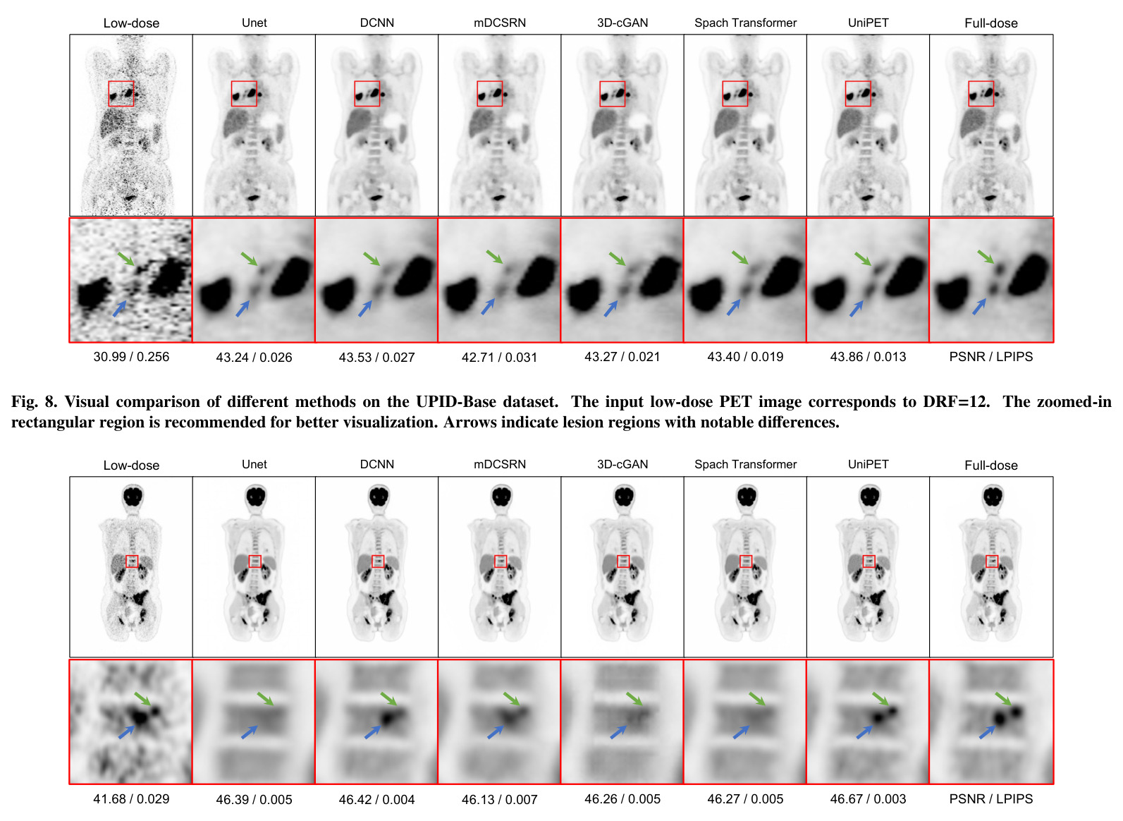 Visual comparison of different methods on the UPID-Base dataset.