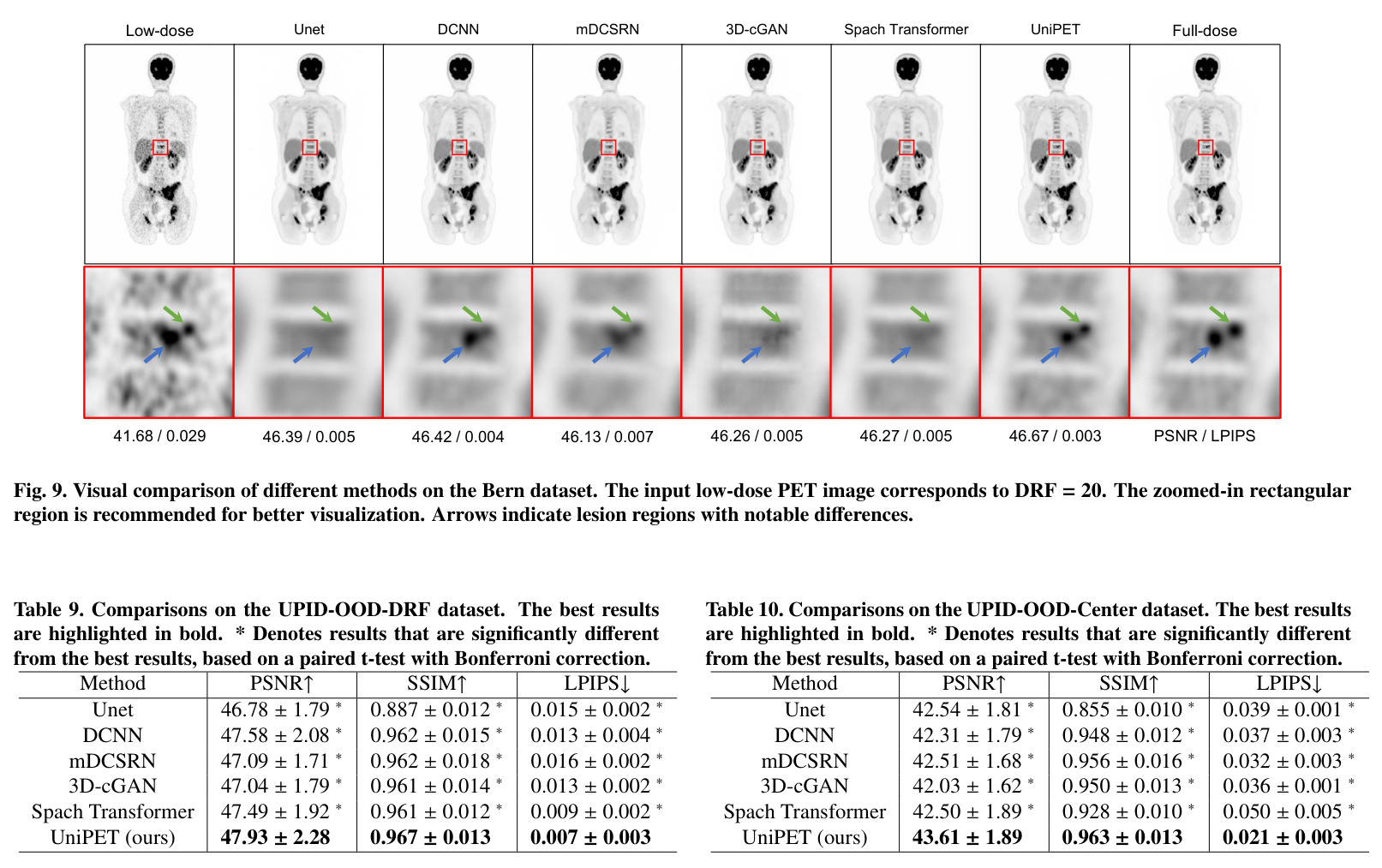 Reader score comparisons on the UPID-Base dataset.