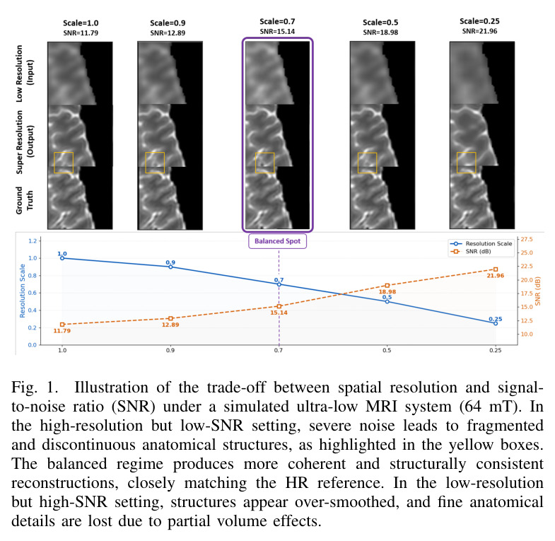 Effect of input resolution on super-resolution quality on the simulated IXI dataset.