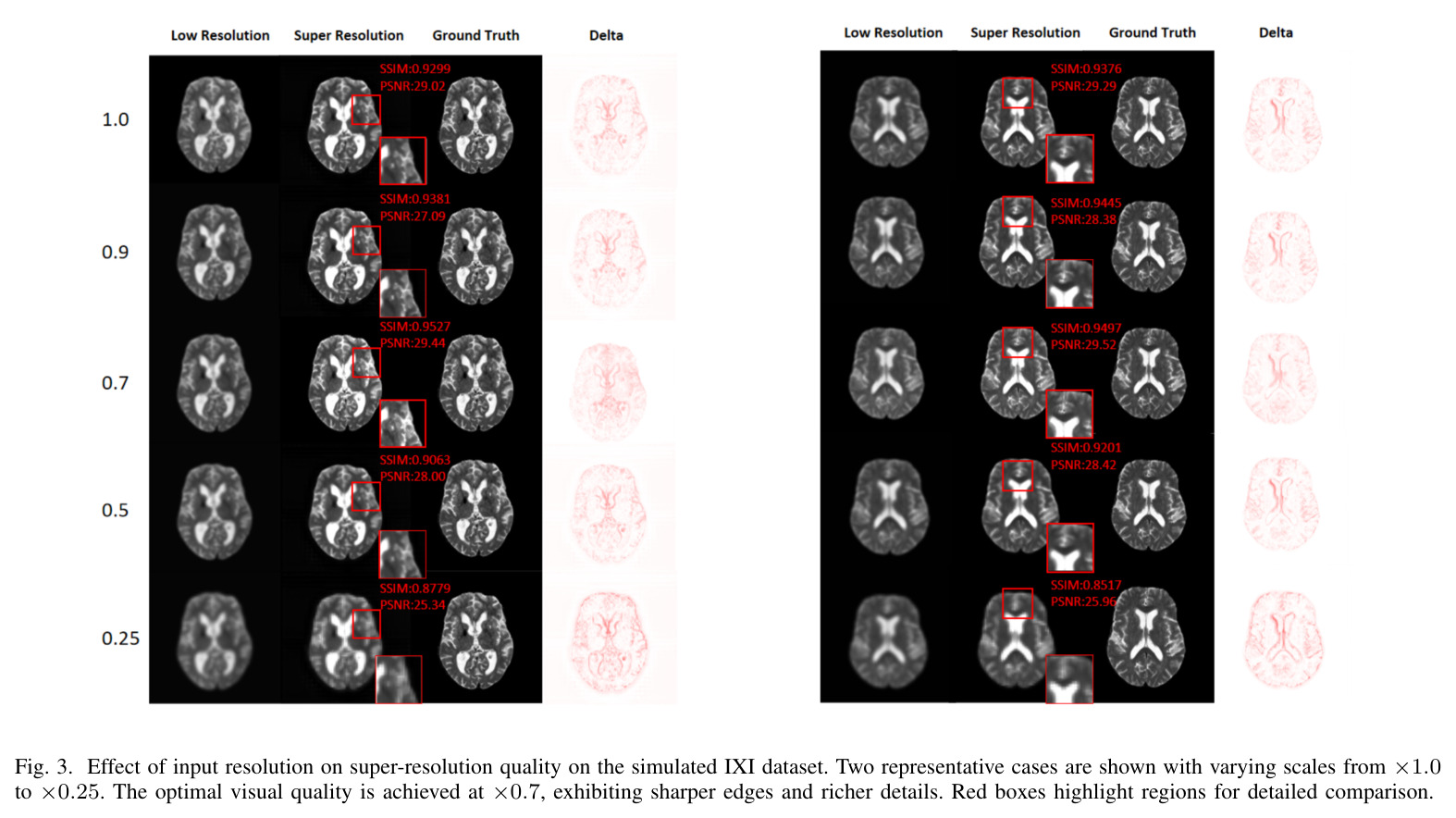 The qualitative results on three simulated datasets under the optimal input resolution.