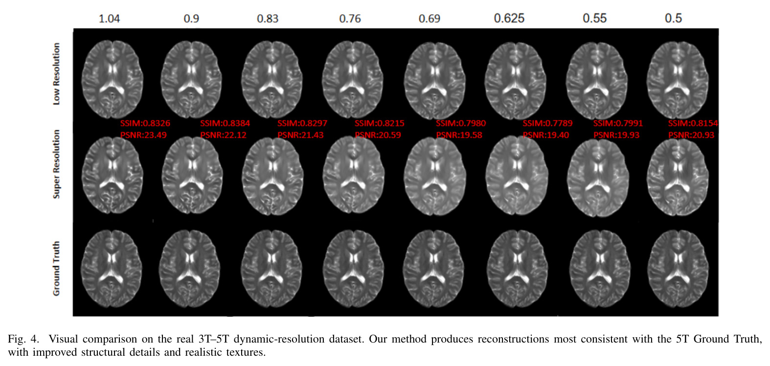 Visual comparison on real 64mT-3T dataset.