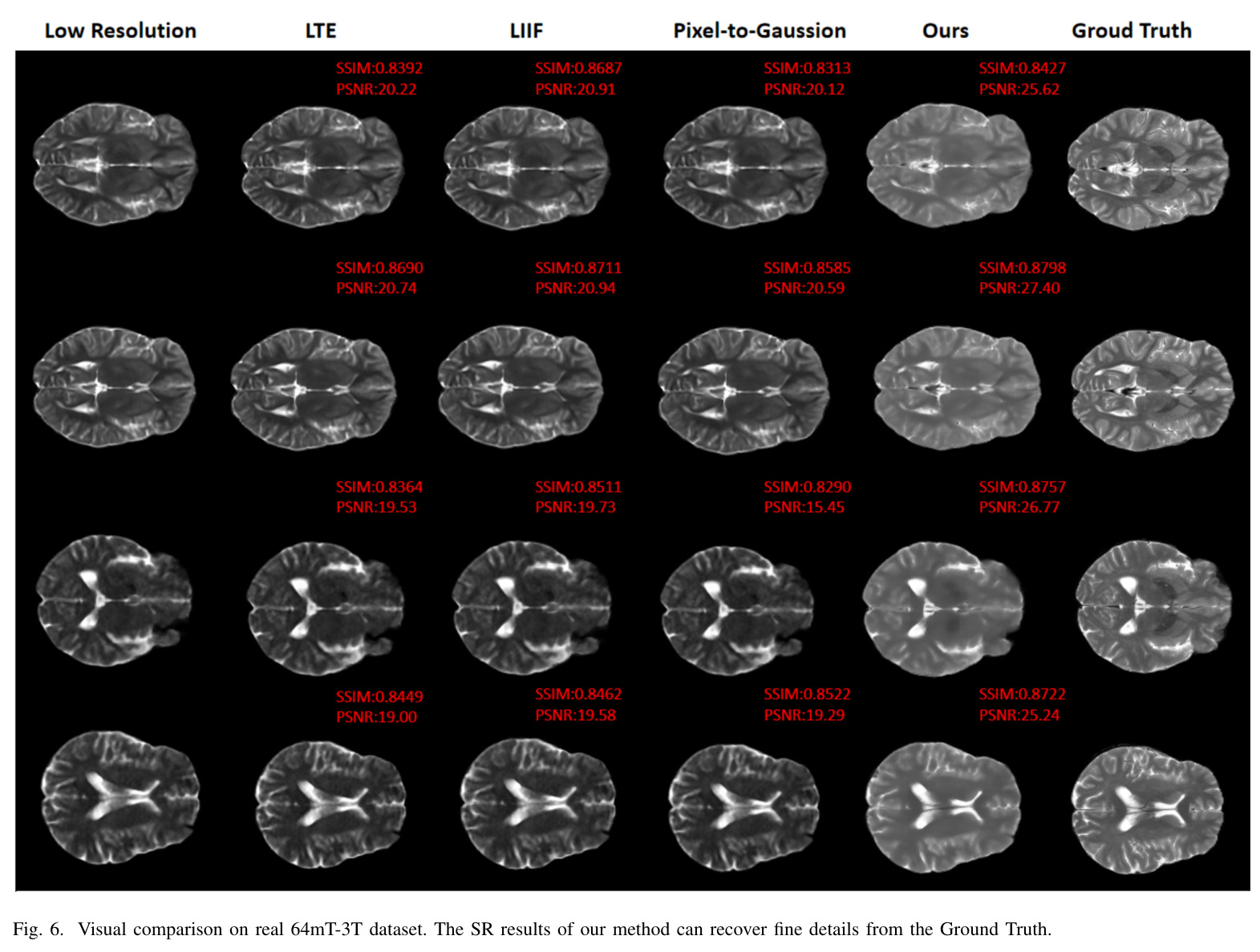 Quantitative comparison on the FastMRI brain benchmark.