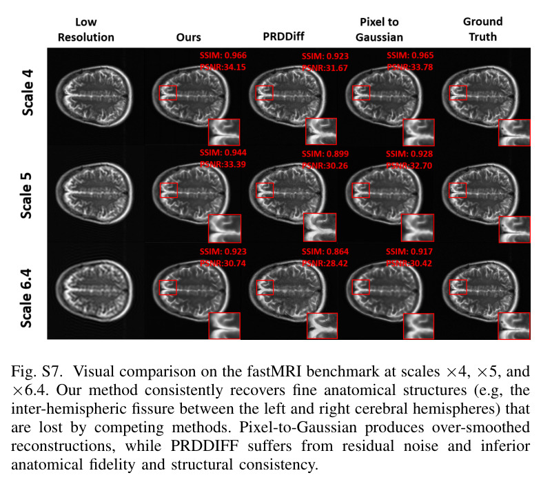 Illustration of the trade-off between spatial resolution and signal-to-noise ratio (SNR) under a simulated ultra-low MRI system (64 mT).