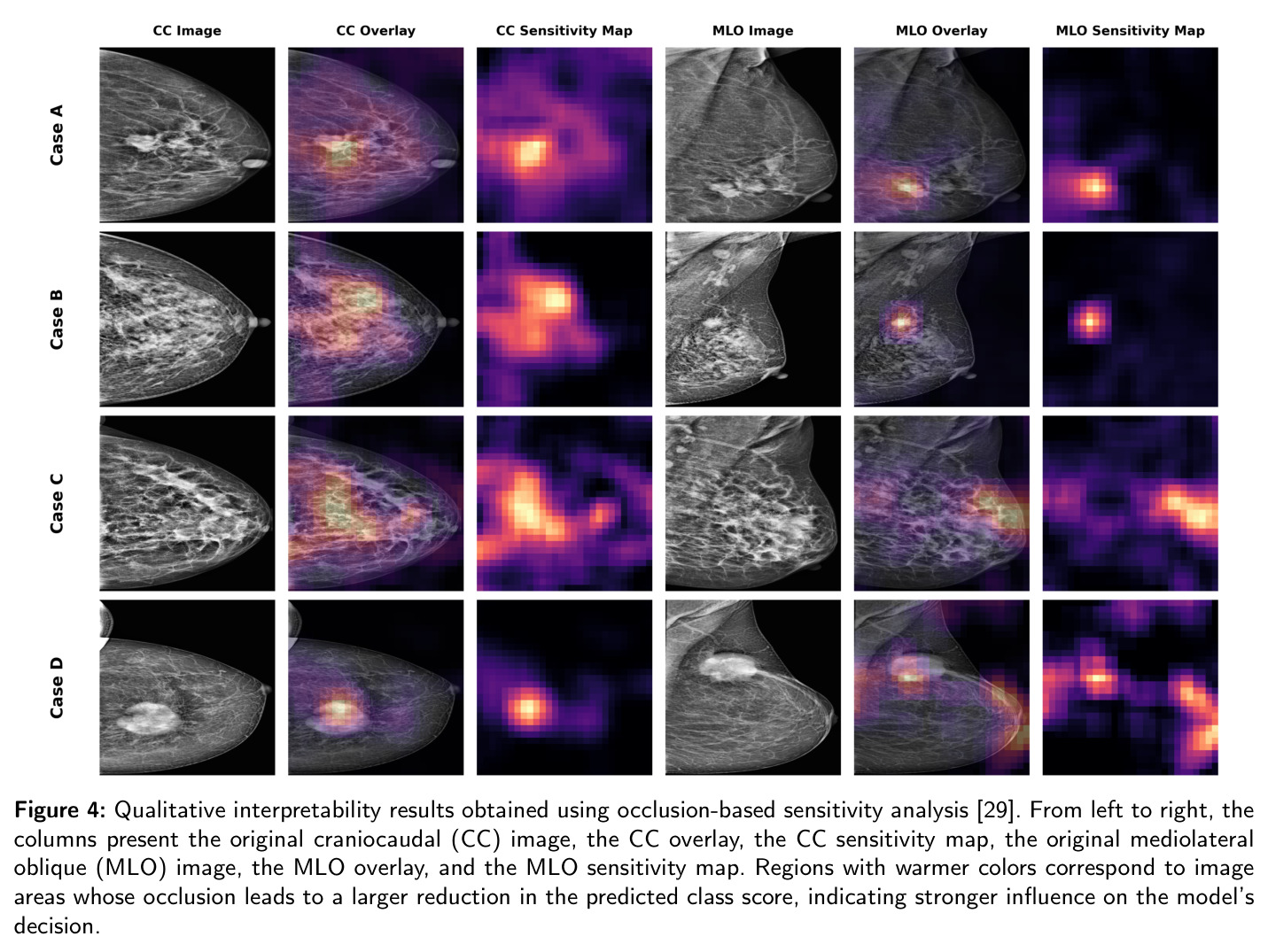 The model's interpretability using occlusion-based sensitivity analysis, highlighting the regions most influential to the prediction.