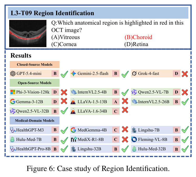 Case study of Region Identification.