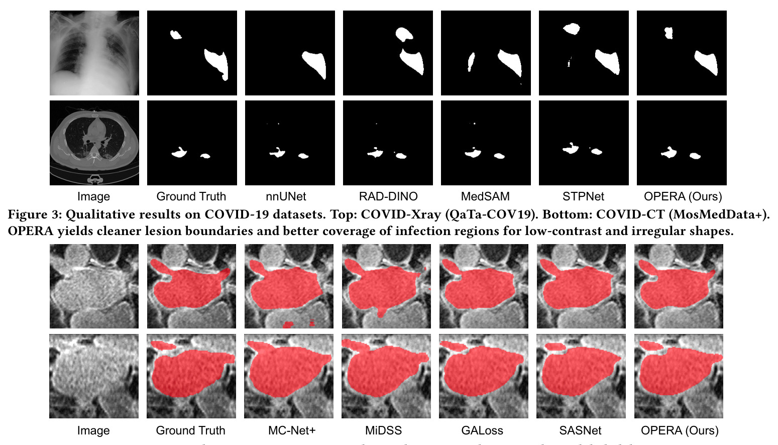 Qualitative results on COVID-19 datasets